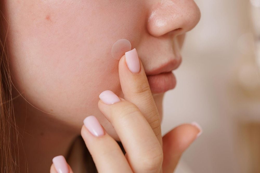Cách dùng miếng dán mụn đúng cách trên da mặt